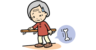 「骨粗しょう症予防相談会」…在宅介護支援センターかめだなかの